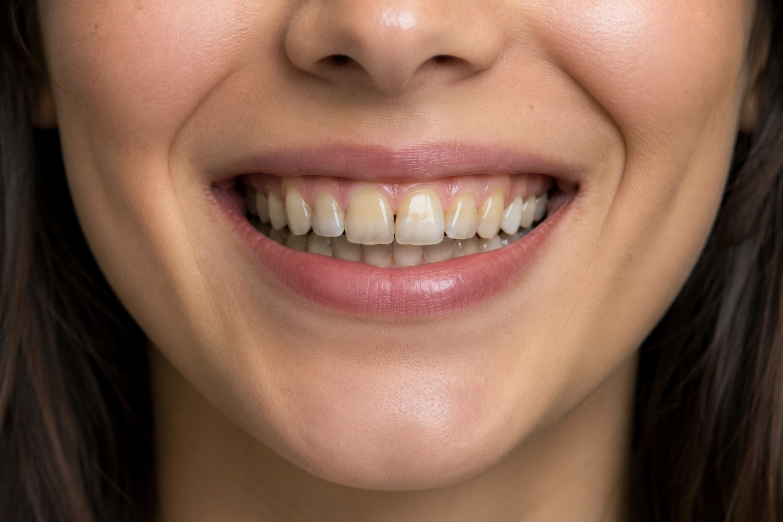 Smile Design